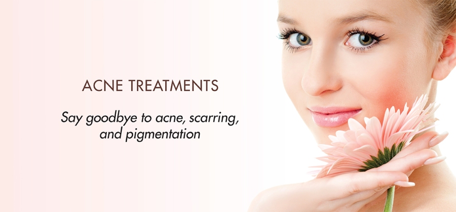 Acne Treatment is a Solution for Flawless Skin
